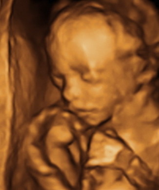 22 hetes magzat ultrahang képe - CsodaBent 4d ultrahang
