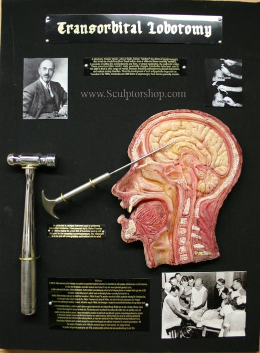 transorbital lobotomy walter freeman curio medical by sculptured