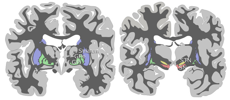 6. Vénusz-Basal-ganglia-coronal-sections-large.png