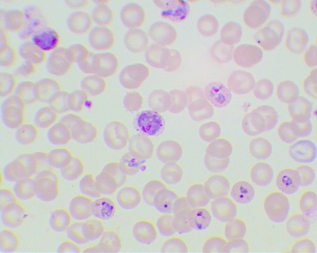 plasmodium vivax2 (Ho)